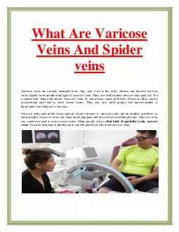 What Are Varicose Veins And Spider veins?