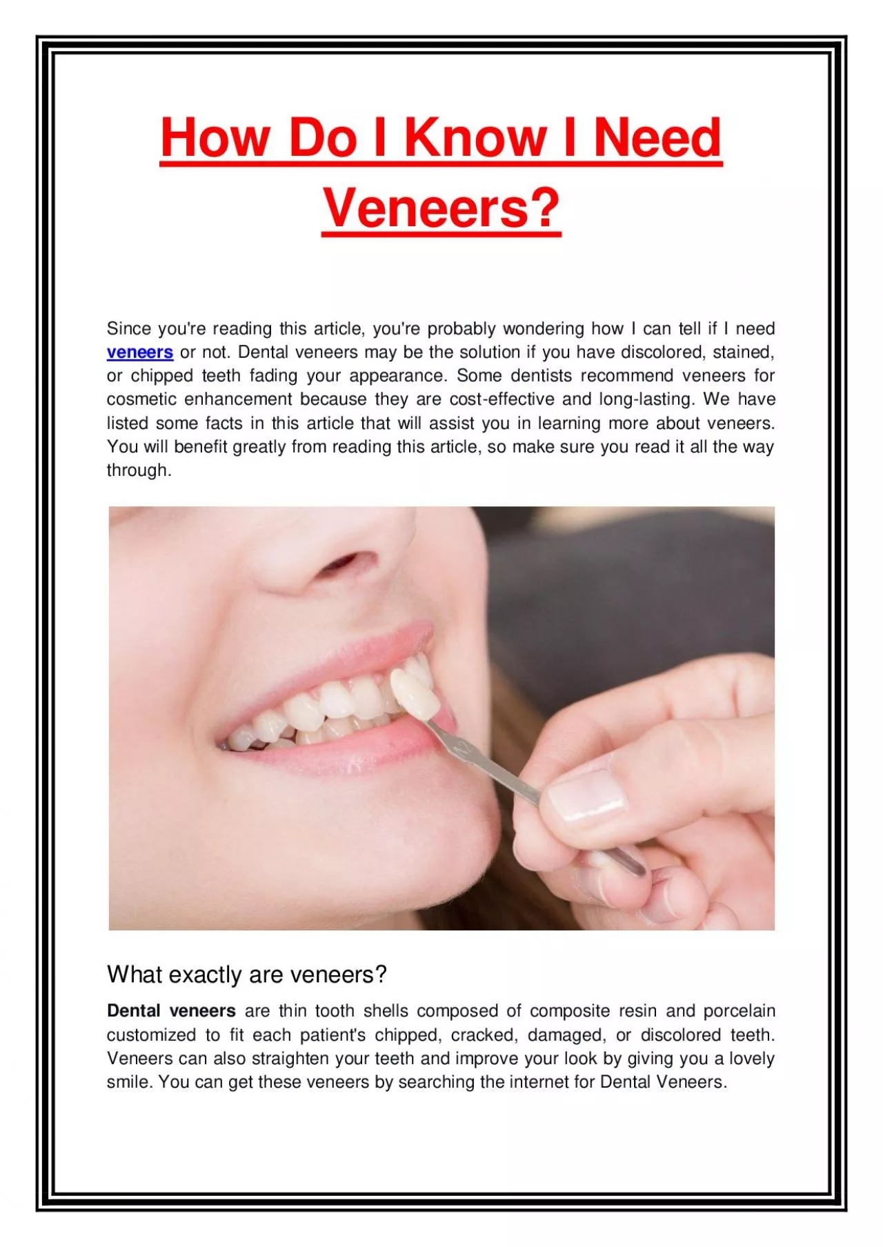 How Do I Know I Need Veneers?