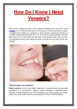 How Do I Know I Need Veneers?