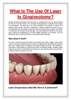 What Is The Use Of Laser In Gingivectomy?