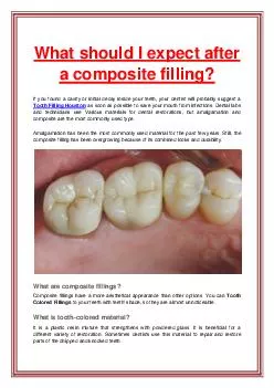 What should I expect after a composite filling?