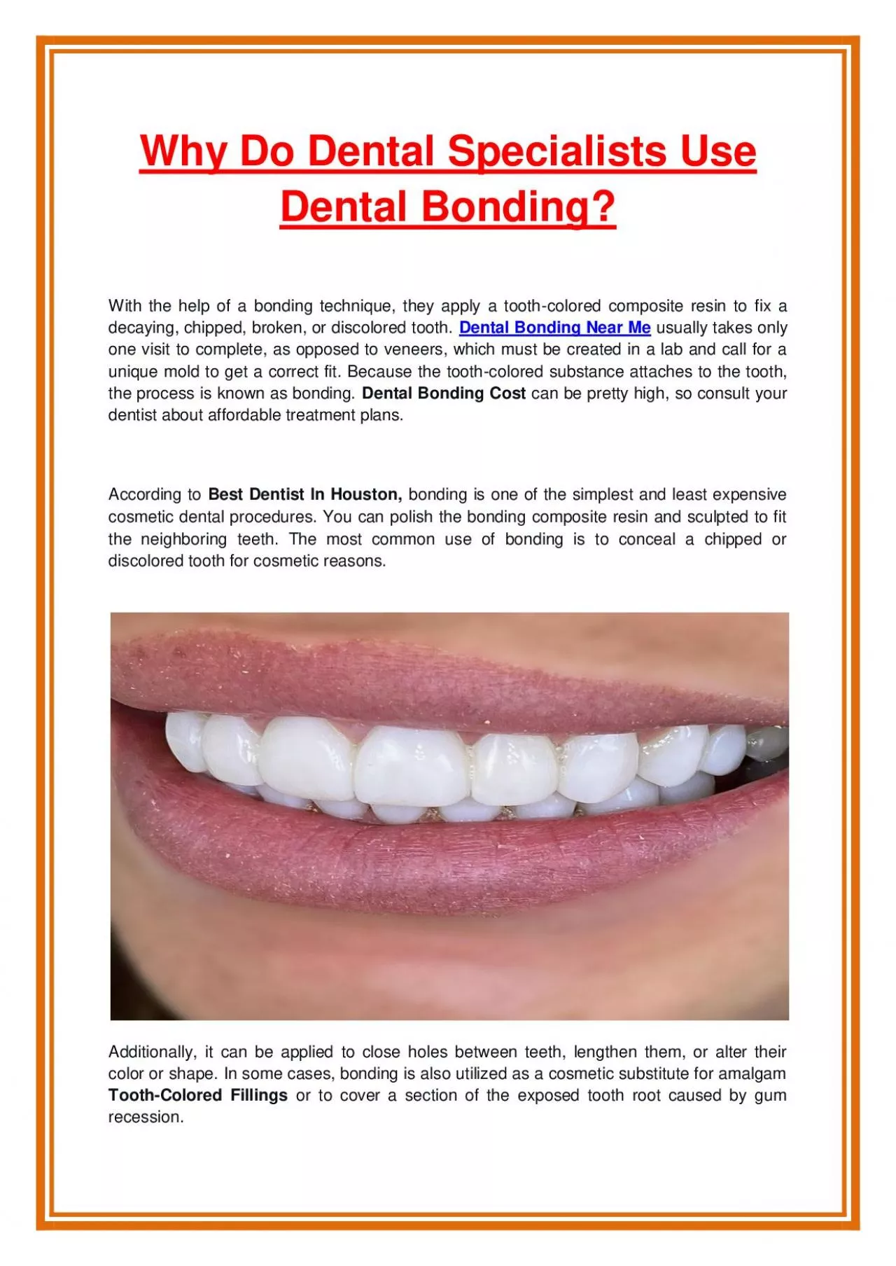 PDF-Why Do Dental Specialists Use Dental Bonding?