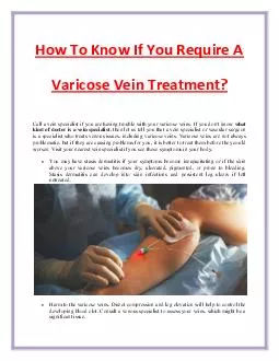 How To Know If You Require A Varicose Vein Treatment?