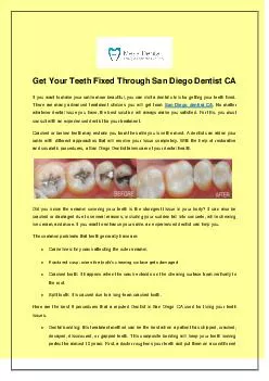 Get Your Teeth Fixed Through San Diego Dentist CA