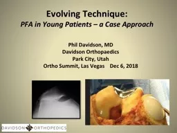 Evolving Technique: PFA in Young Patients