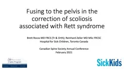 Fusing to the pelvis in the correction of scoliosis associated with Rett syndrome