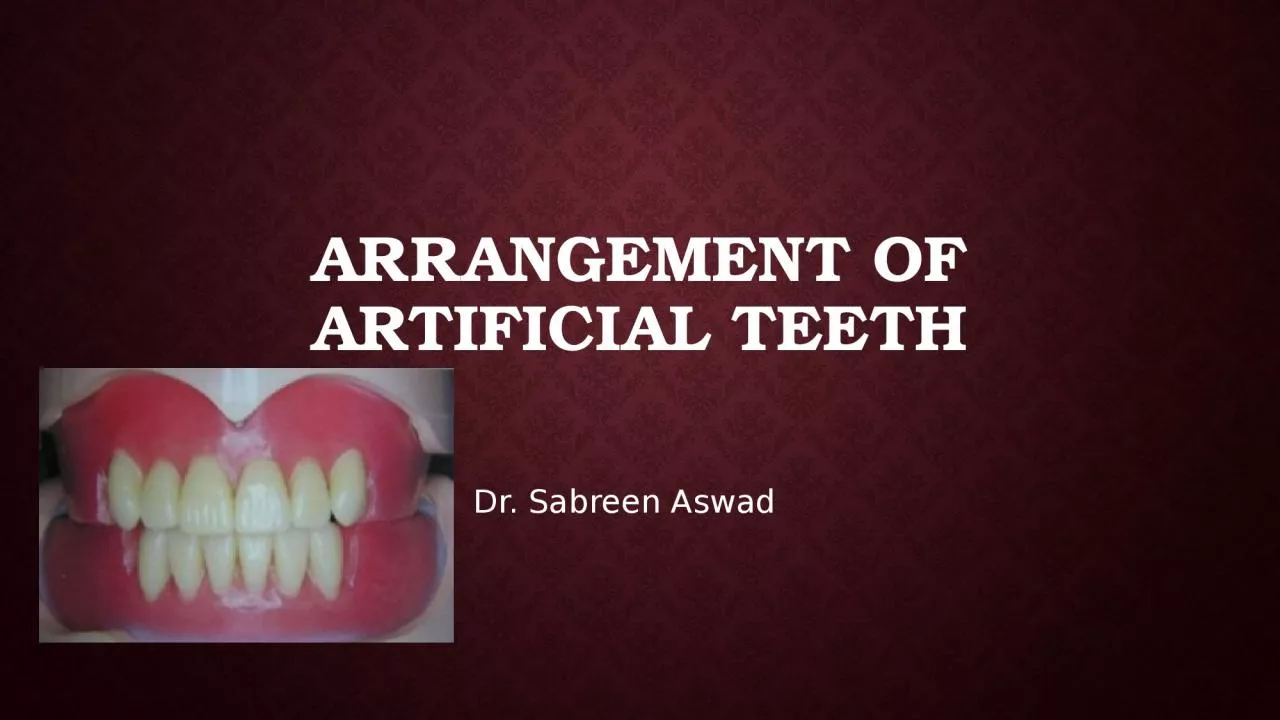 Arrangement of artificial teeth