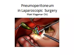 Pneumoperitoneum  in Laparoscopic