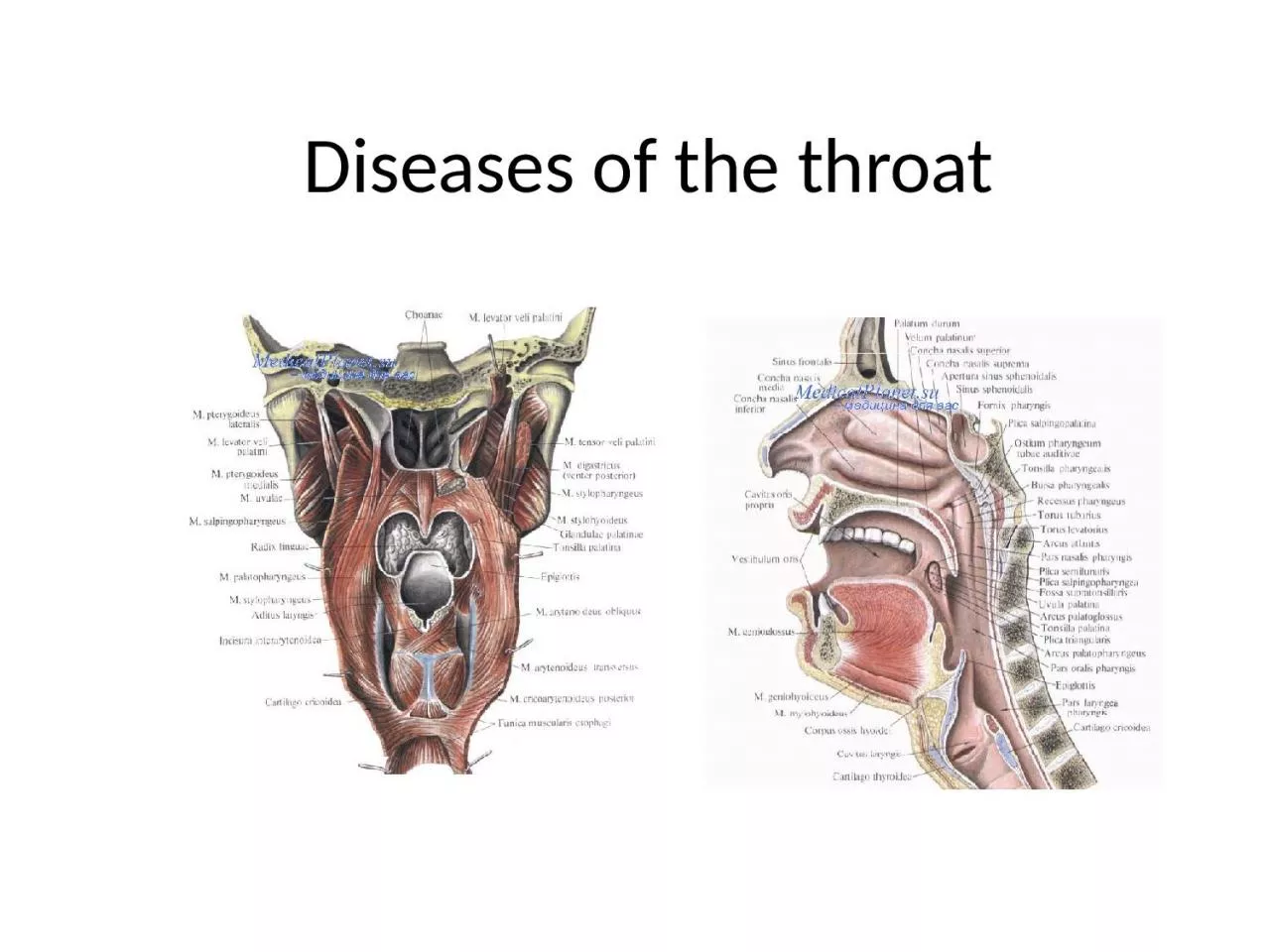 PPT-Diseases of the throat Acute tonsillitis is a general infectious disease in which the