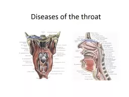 Diseases of the throat Acute tonsillitis is a general infectious disease in which the