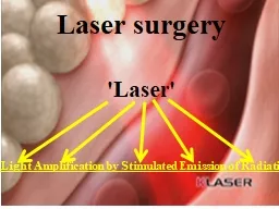 Laser surgery 'Laser' 'Light Amplification by Stimulated Emission of Radiation