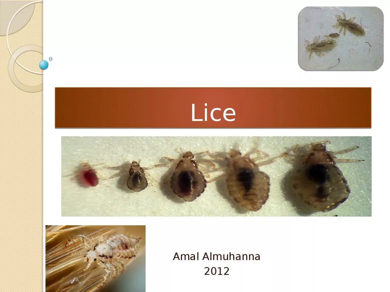 PPT-Lice Amal Almuhanna 2012