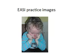 EASI practice images Start with some body surface area