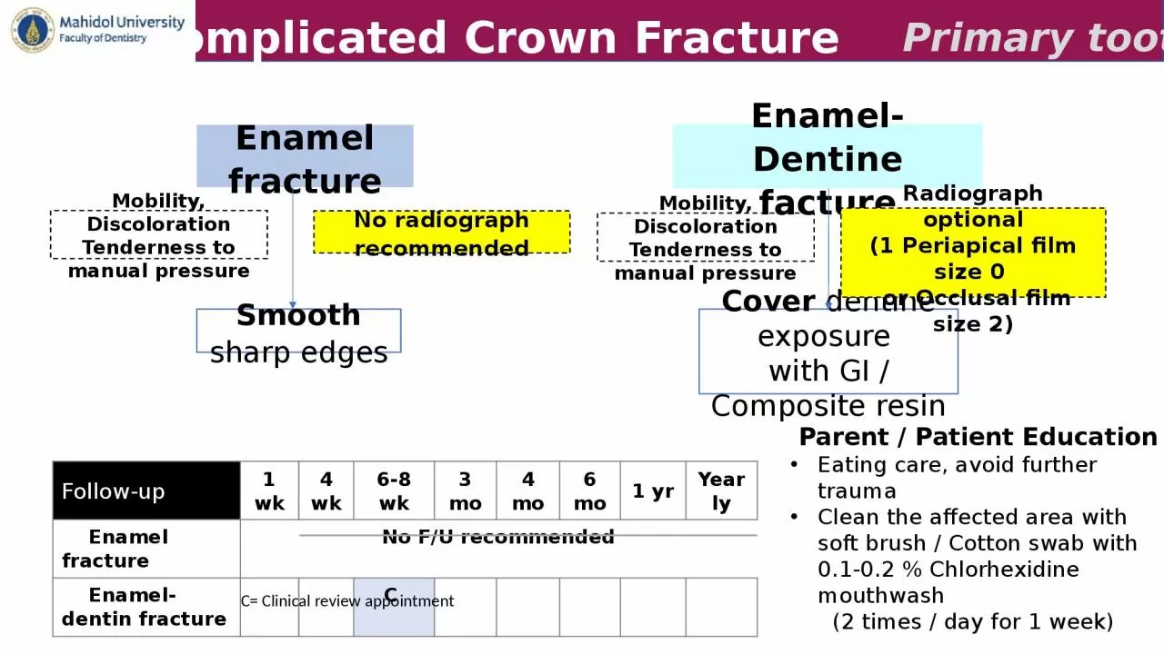 Enamel fracture Enamel-Dentine facture