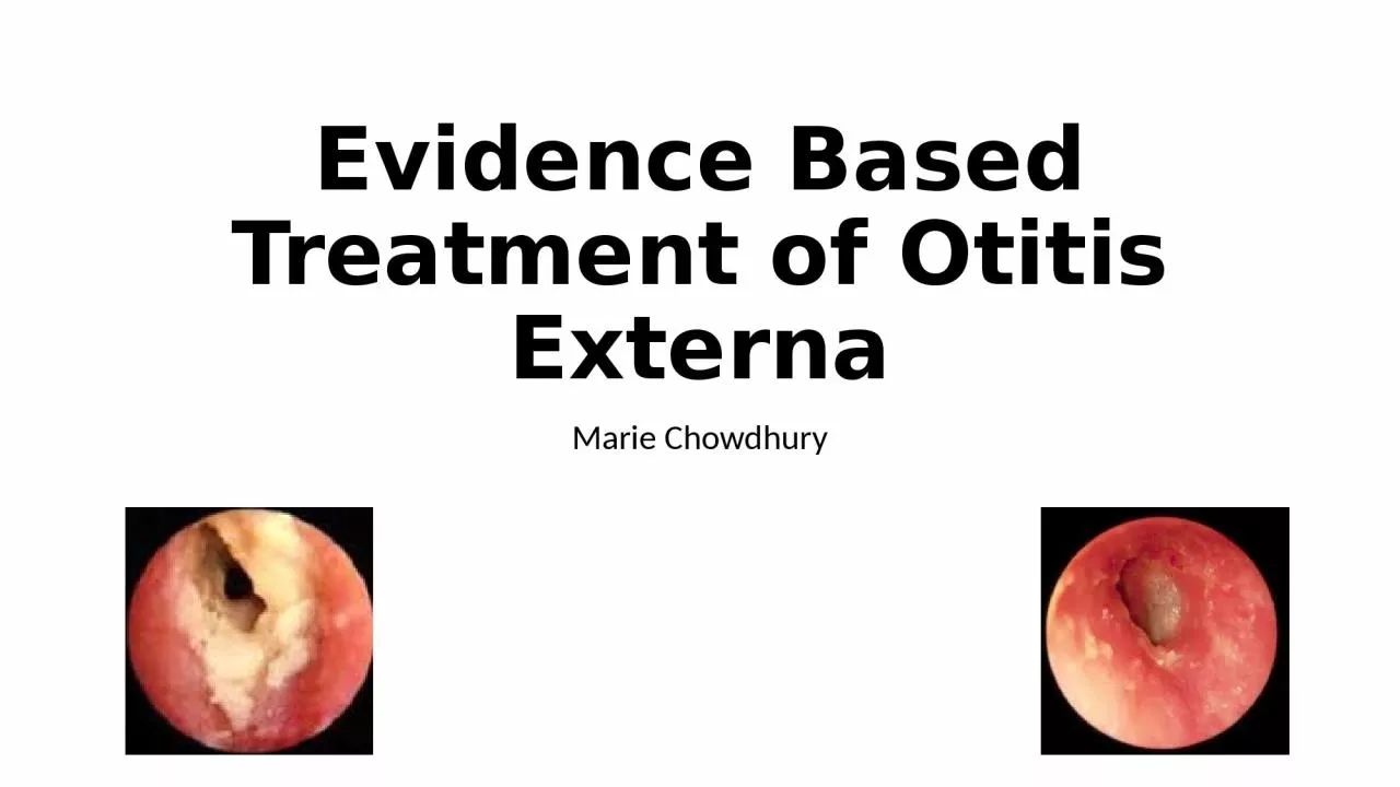Evidence Based Treatment of Otitis Externa