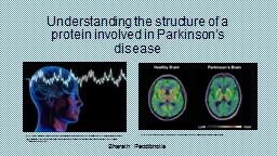 Understanding the structure of a protein involved in Parkinson’s disease