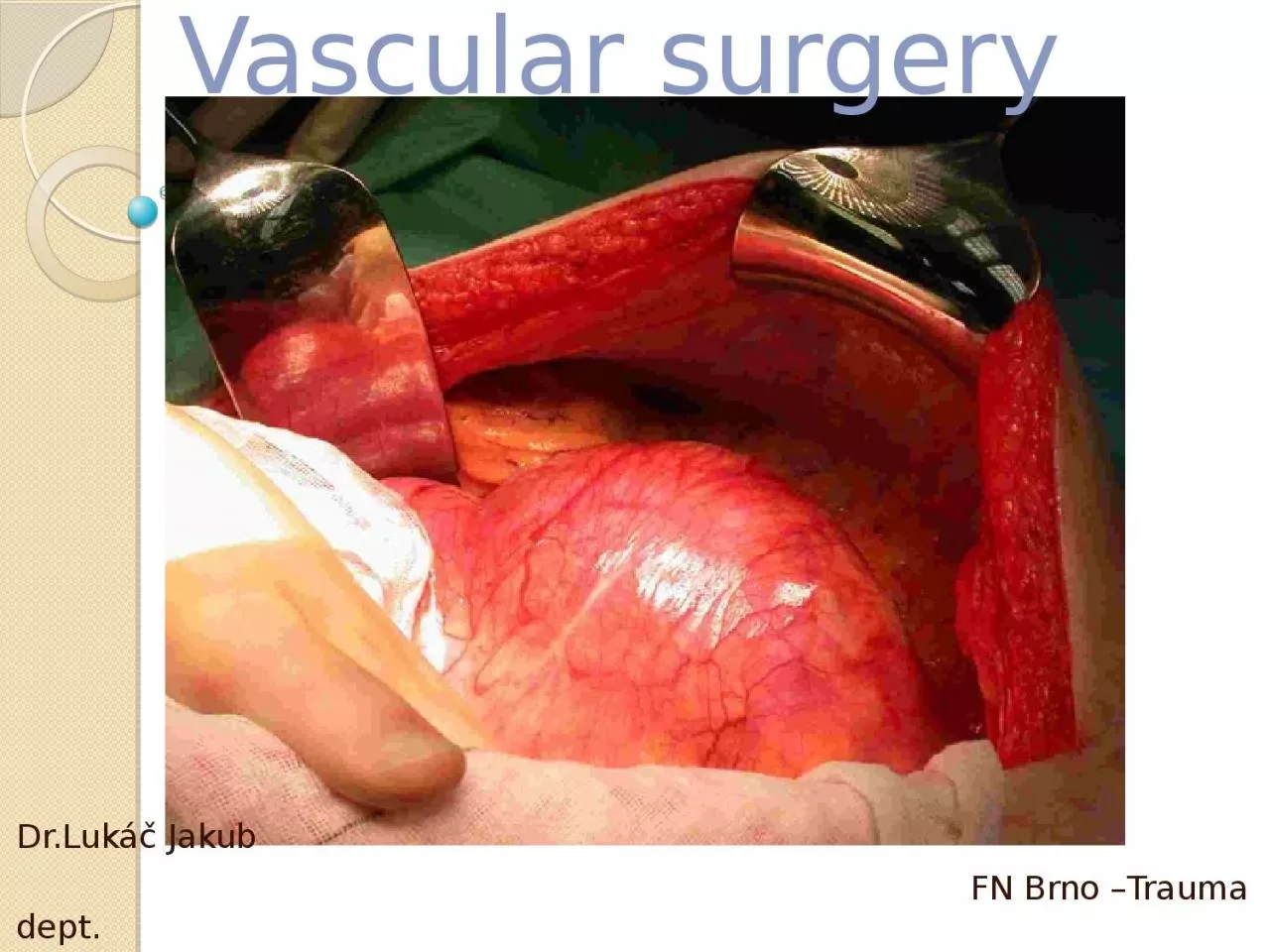 Vascular surgery