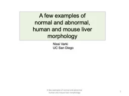 A few examples of  normal and abnormal,