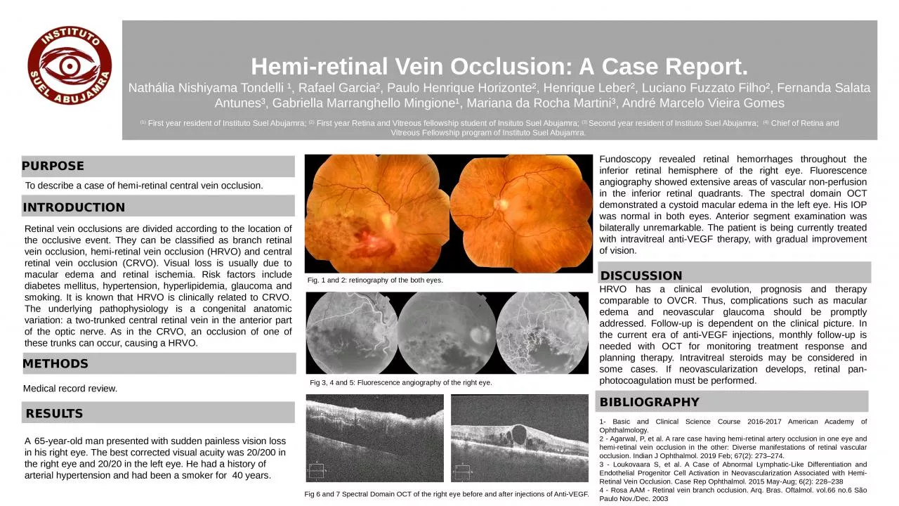 PPT-Hemi-retinal Vein Occlusion