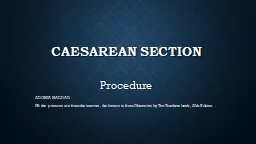 Caesarean  section Procedure