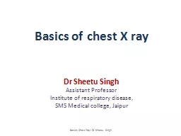 Basics of chest X ray Dr