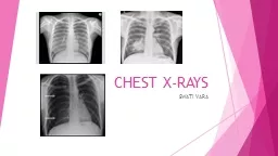 CHEST X-RAYS SWATI VARA Contents