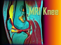 MRI Knee Menisci:  Tears/Degeneration