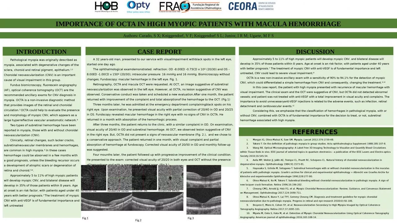 IMPORTANCE OF OCTA IN HIGH MYOPIC PATIENTS WITH MACULA HEMORRHAGE
