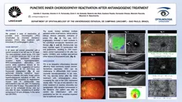 CASE REPORT A 42 years old woman presented with a central scotoma in her left eye for 20 days. The
