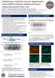 Establishing a model for macular degeneration using CRISPR-Cas9 gene editing and human