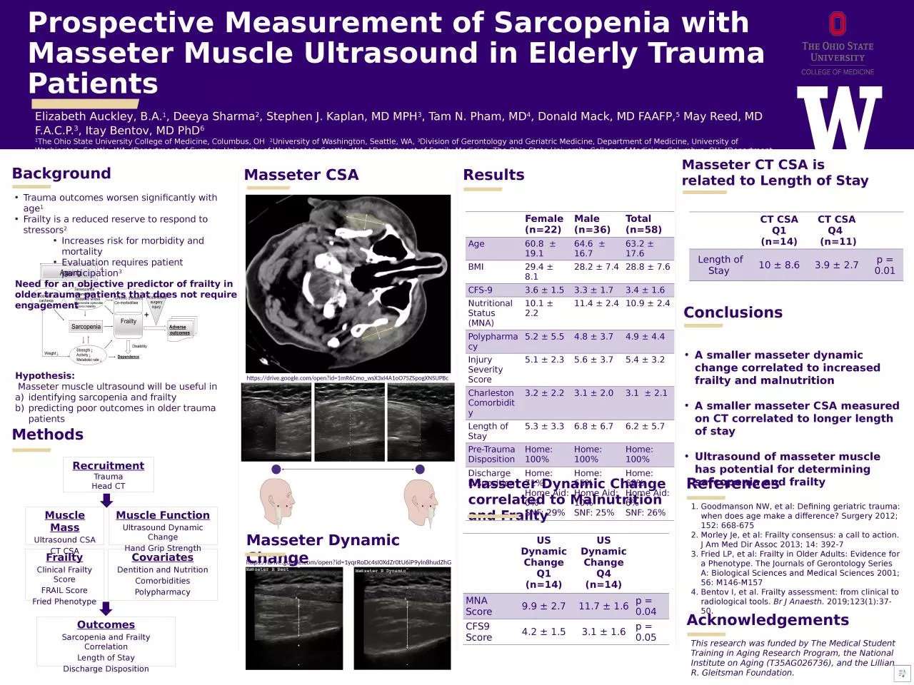 Prospective Measurement of Sarcopenia with Masseter Muscle Ultrasound in Elderly Trauma