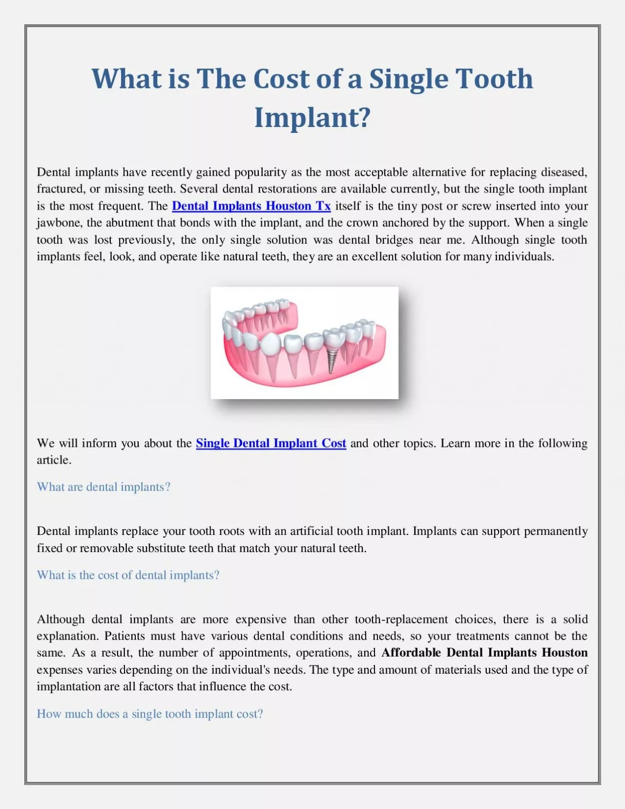 PDF-What is The Cost of a Single Tooth Implant?