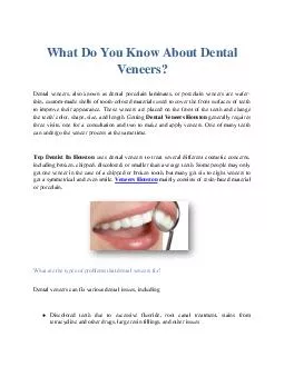 What Do You Know About Dental Veneers?