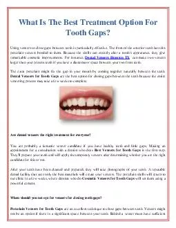 What Is The Best Treatment Option For Tooth Gaps?