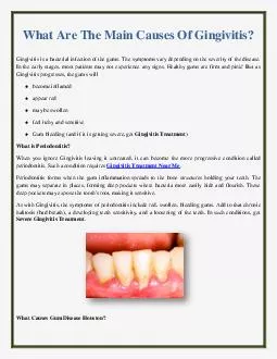 What Are The Main Causes Of Gingivitis?