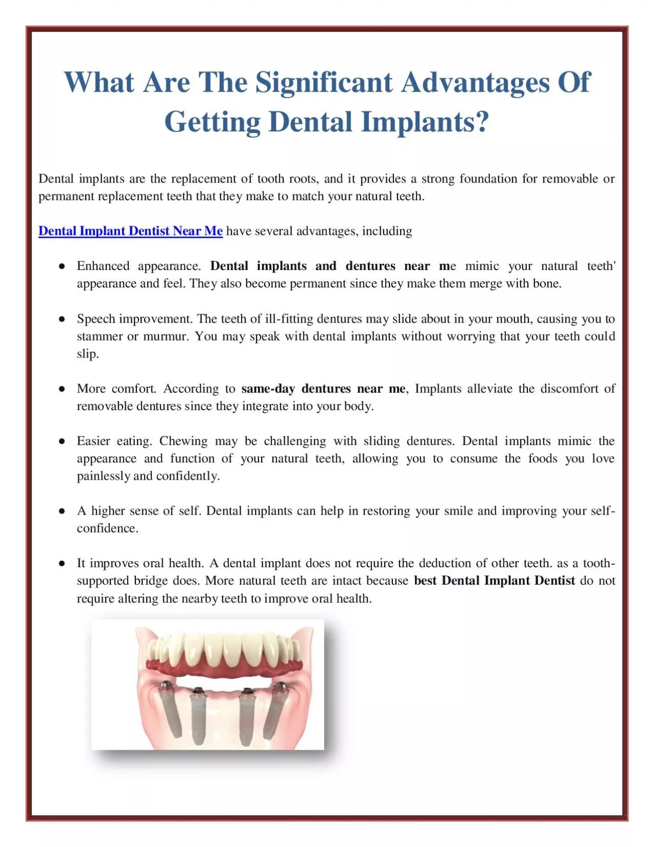 What Are The Significant Advantages Of Getting Dental Implants?