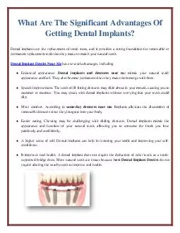 What Are The Significant Advantages Of Getting Dental Implants?