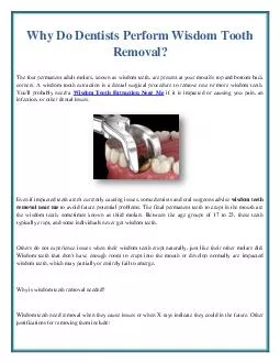 Why Do Dentists Perform Wisdom Tooth Removal?