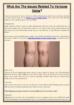 What Are The Issues Related To Varicose Veins?