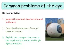 Common problems of the eye