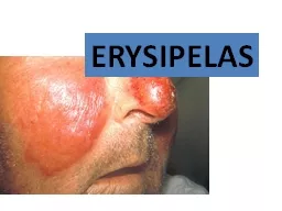 ERYSIPELAS   Erysipelas is an acute spreading inflammation of the upper dermis and superficial