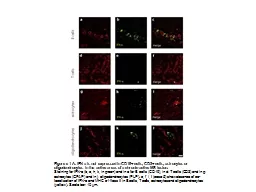 Figure e-1 A: IFN-a is not expressed in CD19+ cells, CD3+ cells, astrocytes or