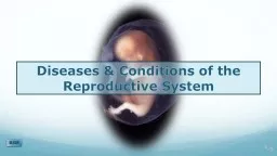 Diseases & Conditions of the Reproductive System