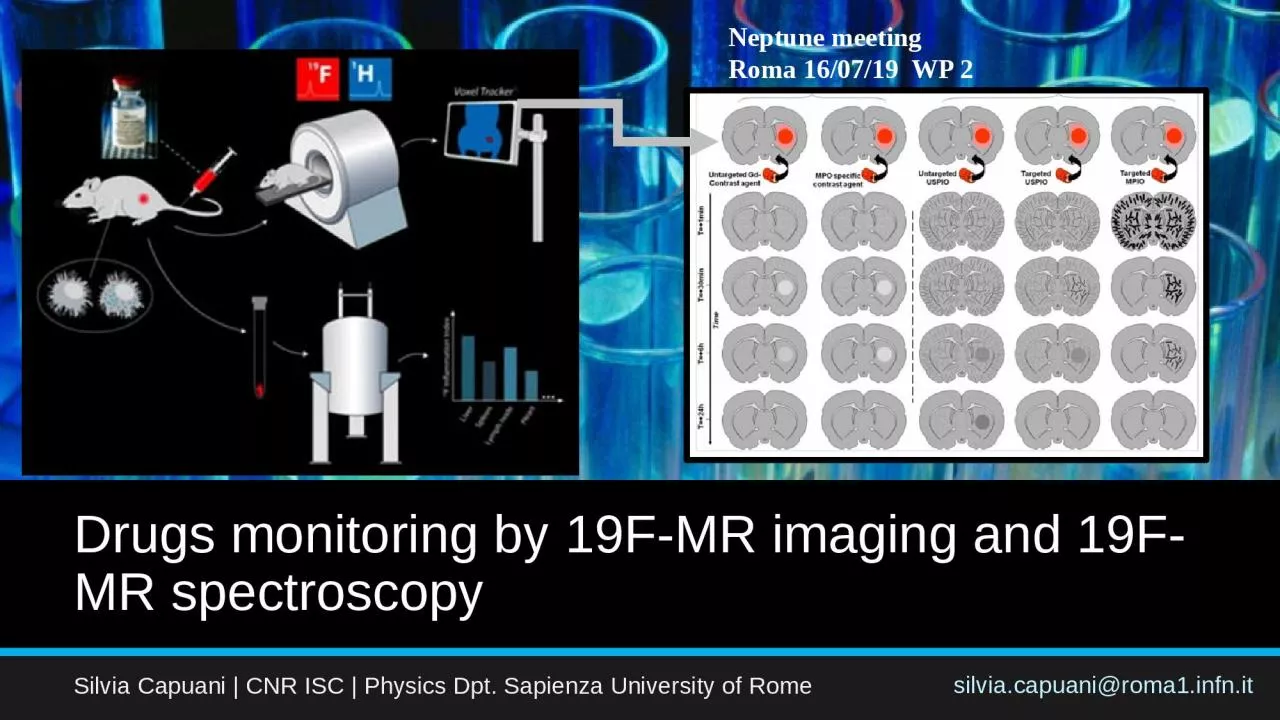 Drugs  monitoring by 19F-MR imaging and 19F-MR spectroscopy