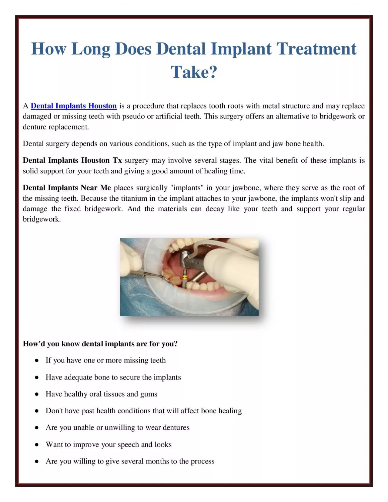 PDF-How Long Does Dental Implant Treatment Take?