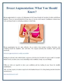 Breast Augmentation: What You Should Know?