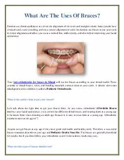 What Are The Uses Of Braces?