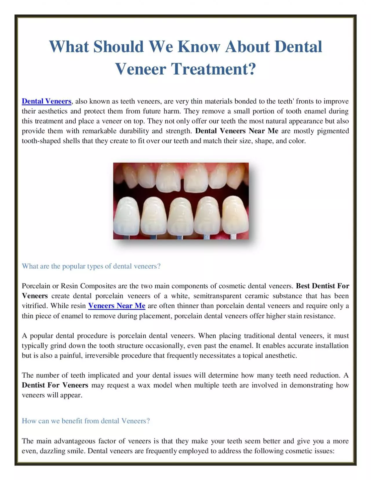 What Should We Know About Dental Veneer Treatment?