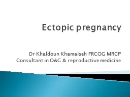 Ectopic pregnancy Dr   Khaldoun
