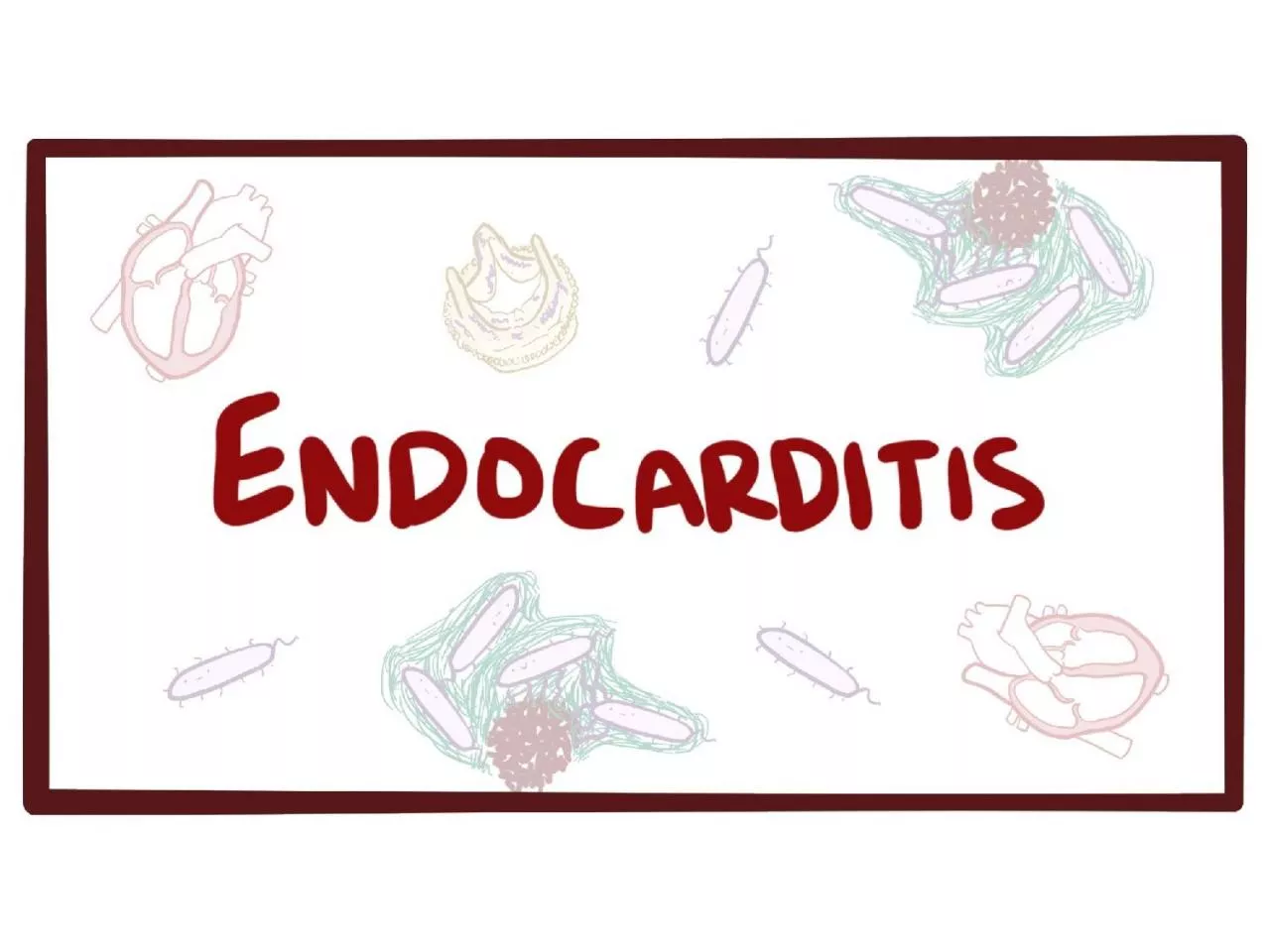 PPT-Endocarditis is an inflammation of the